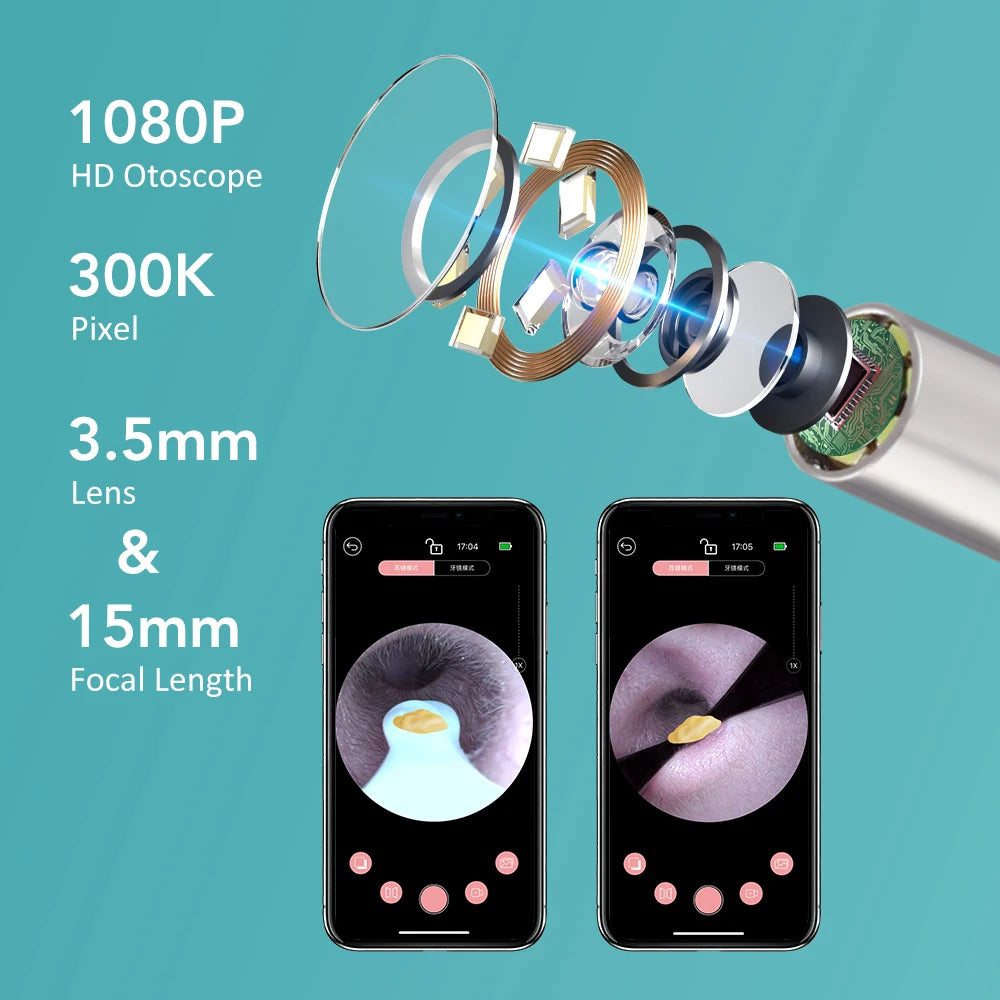Revolutionary Smart Visual Ear Camera Set - HD1080P WiFi Ear Cleaner with Tweezers and Ear Wax Removal Tools