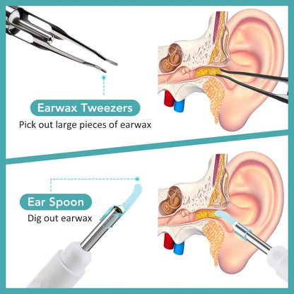 Revolutionary Smart Visual Ear Camera Set - HD1080P WiFi Ear Cleaner with Tweezers and Ear Wax Removal Tools