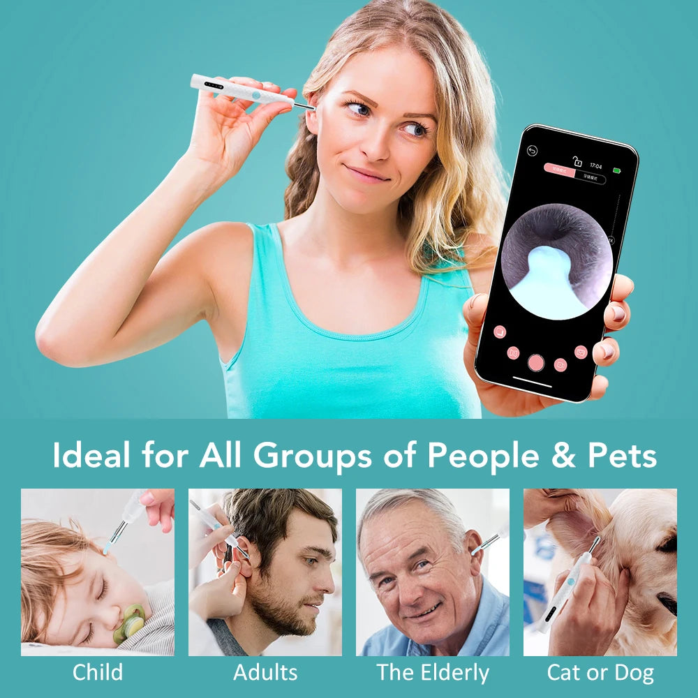 Revolutionary Smart Visual Ear Camera Set - HD1080P WiFi Ear Cleaner with Tweezers and Ear Wax Removal Tools