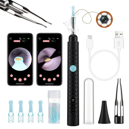 Revolutionary Smart Visual Ear Camera Set - HD1080P WiFi Ear Cleaner with Tweezers and Ear Wax Removal Tools